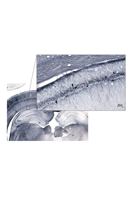 Immunohistochemistry