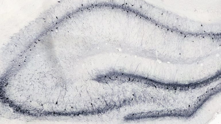 Biomarker Analysis cells